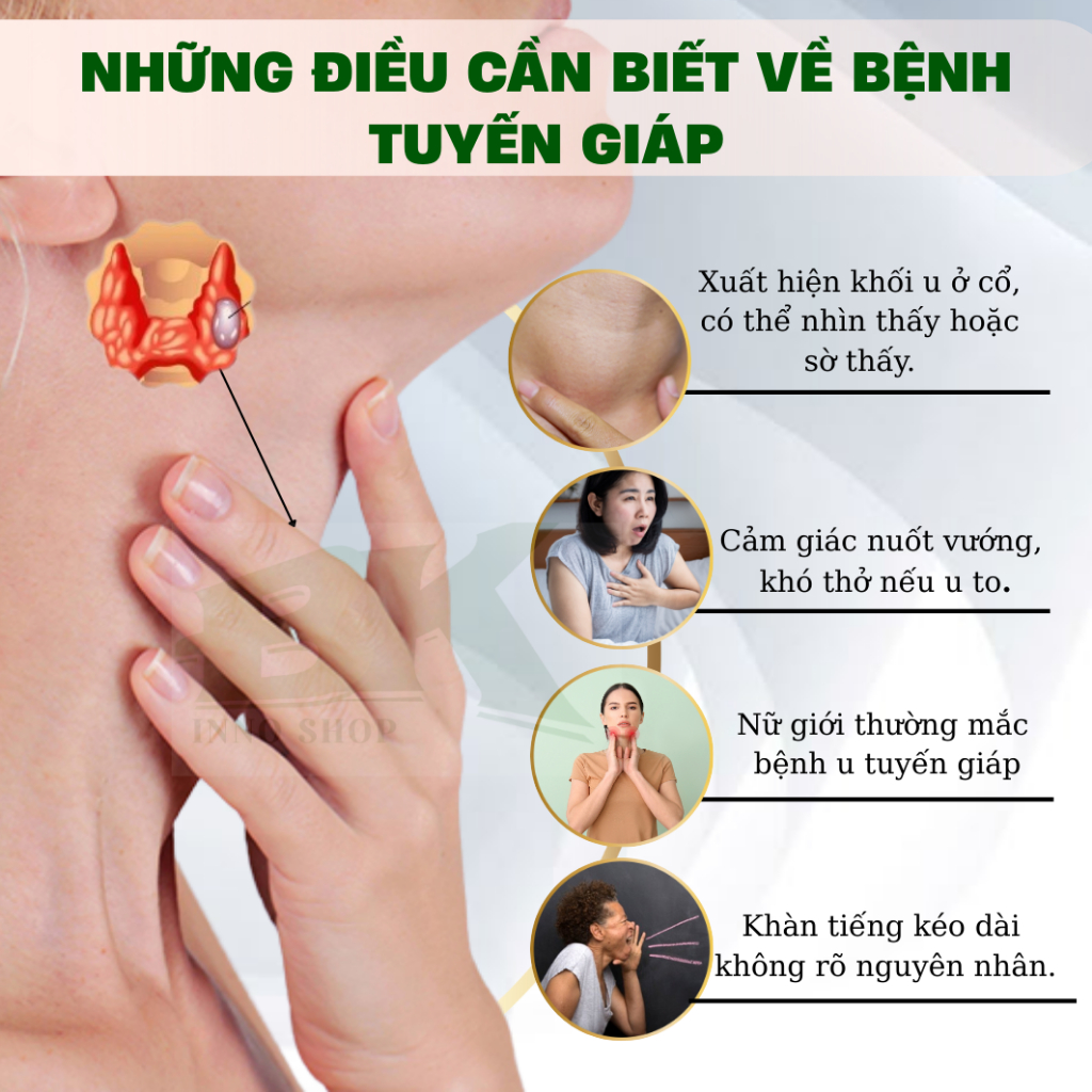 Kem Tan U Tuyến Giáp, Cường Giáp Senjoko Nhật Bản 50g – Giảm Sưng Đau, Làm Dịu Viêm Tuyến Giáp Dưỡng Da Khỏe  | BK INNO