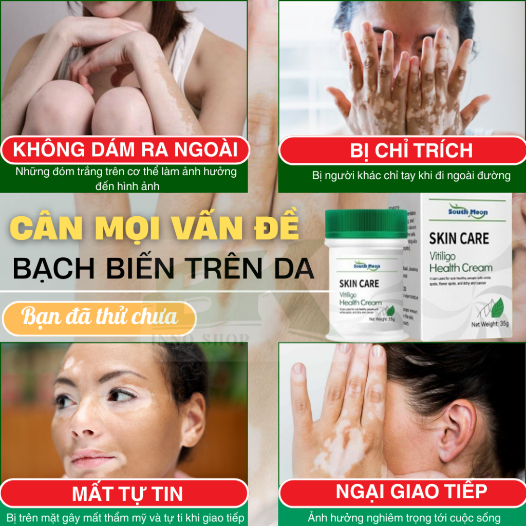 Kem Tan Bạch Biến Southmoon 35g – Giúp Giảm Sắc Tố, Làm Đều Màu Da, Dưỡng Da Sáng Mịn, Giảm Tiết Mồ Hôi  | BK INNO