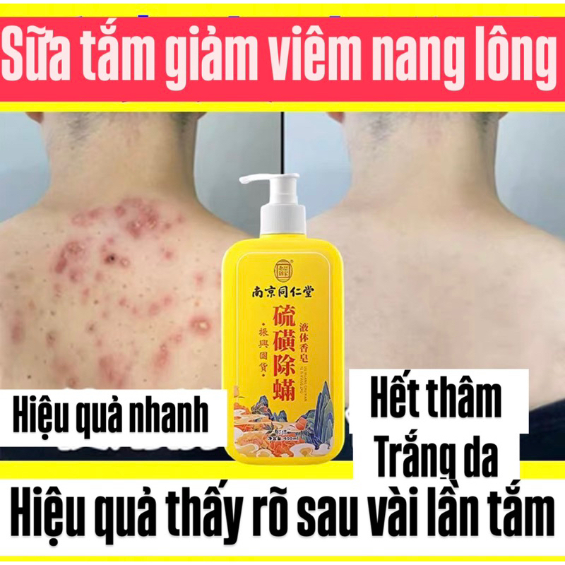 Sữa Tắm Gội 3 in 1 Giảm Mụn Lưng, Giảm Viêm Nang Lông, Sạch Thâm Đồng Nhân Đường- Giảm Ngứa, Kháng Khuẩn 400ML