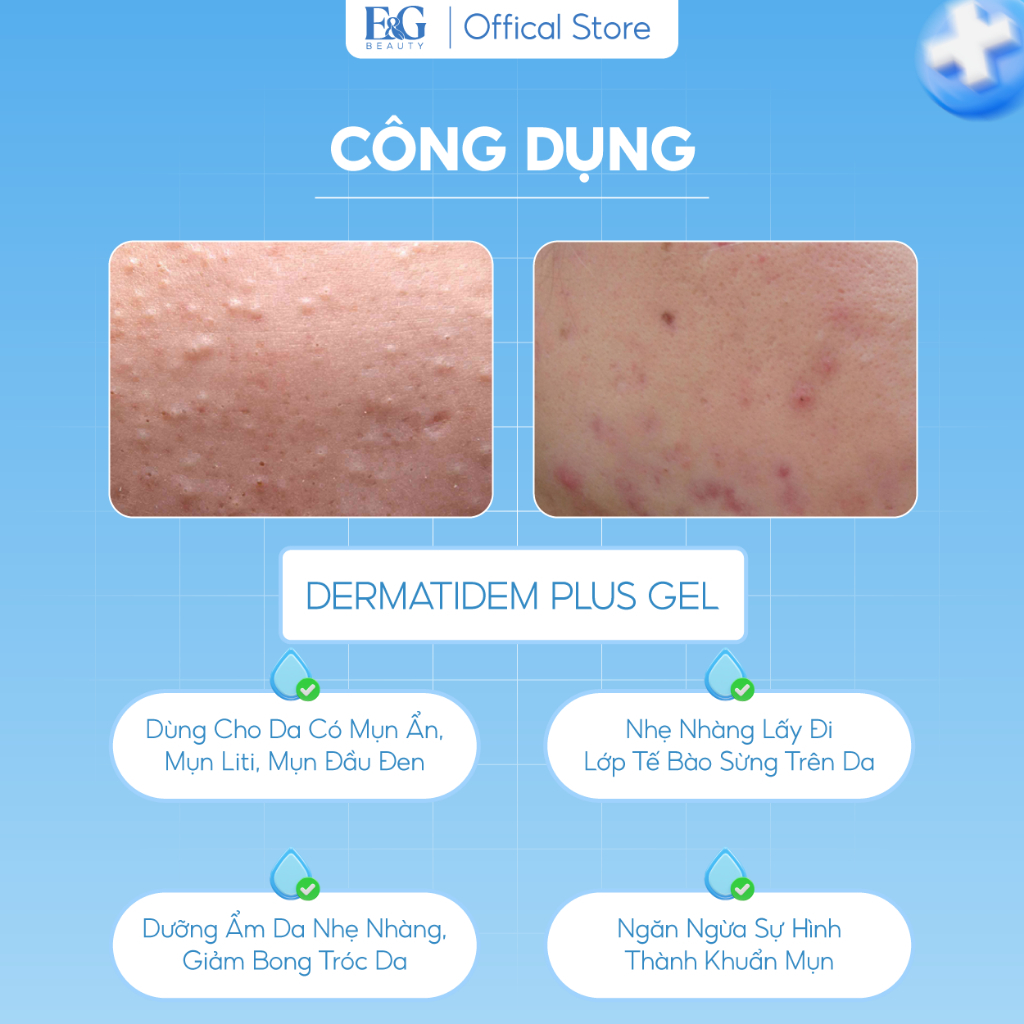 Gel Chấm Giảm Mụn Nhanh Trong 7 Ngày DERMATIDEM PLUS 20g Giúp Giảm Viêm Mờ Thâm Mụn Gel Mụn | BigBuy360 - bigbuy360.vn
