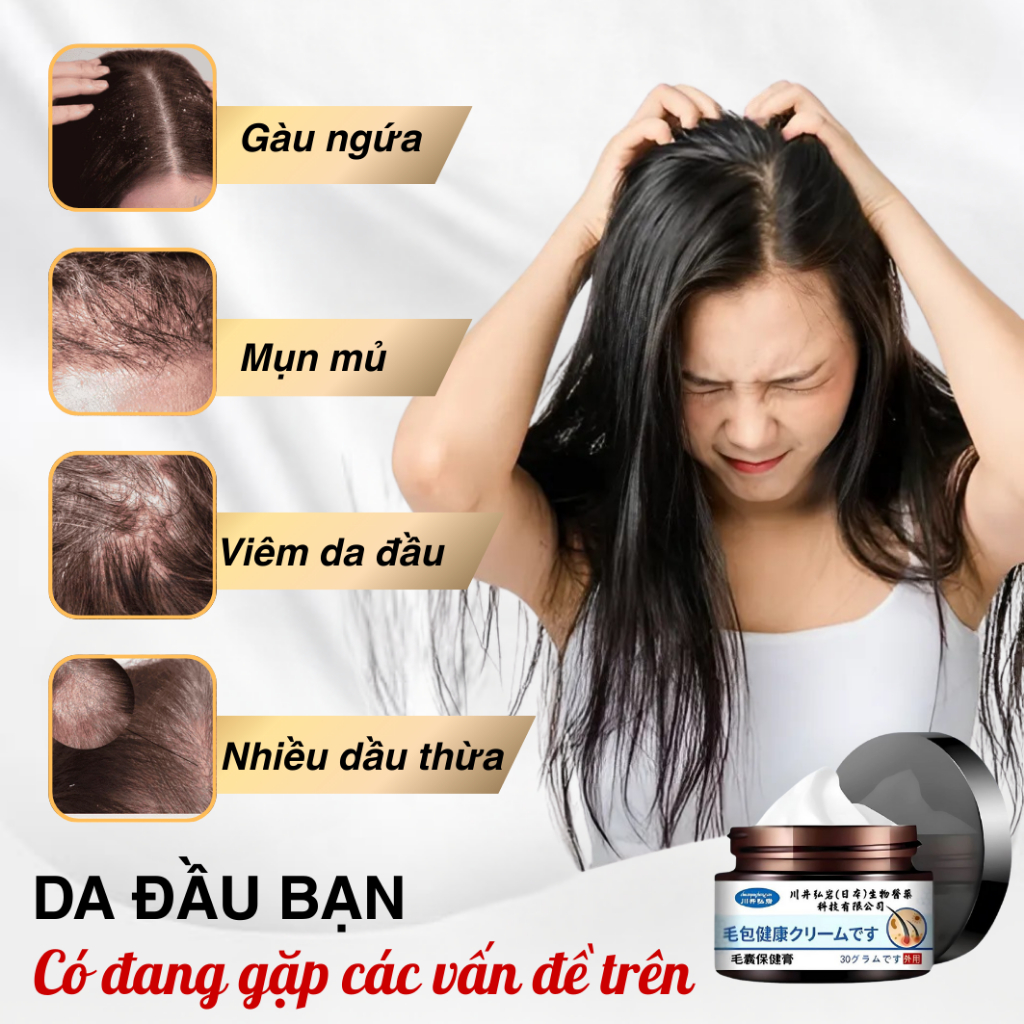 Kem Bôi Viêm Nang Tóc Sakaido 30g – Giảm Ngứa, Loại Bỏ Viêm Nang Tóc, Sạch Gàu, Vảy Nến,Dưỡng Da Đầu Khoẻ Mạnh | BK INNO