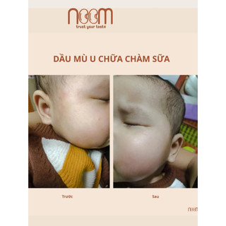 Dầu Mù U Ép Lạnh Noom 100ml