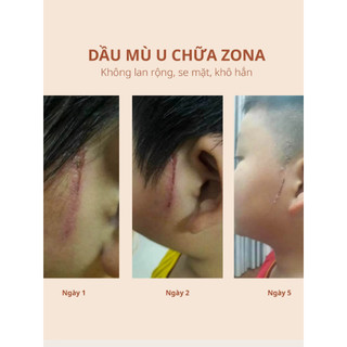 Dầu Mù U Ép Lạnh Noom 100ml