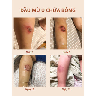 Dầu Mù U Ép Lạnh Noom 100ml