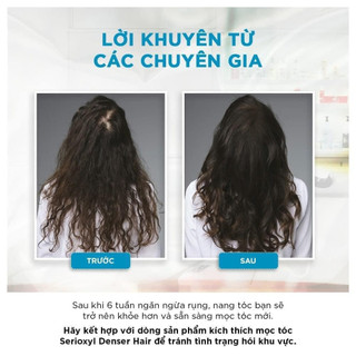 Tinh chất chống rụng tóc Loreal Aminexil Control 6ml