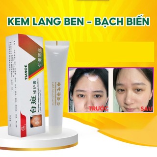 Kem Lang Ben TIANGE Hỗ Trợ Dứt Điểm Lang Ben, Bạch Biến, Chàm Da Hiệu Quả Hàng Xuất Khẩu NGA và THÁI LAN