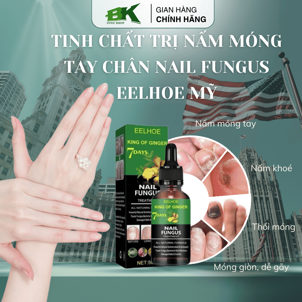Tinh Chất Nấm Móng Tay Chân King of Ginger EELHOE 50ml  – Loại Bỏ Nứt Móng, Thối Bọng Móng, Hư Khóe Tay Chân Hiệu Quả BK