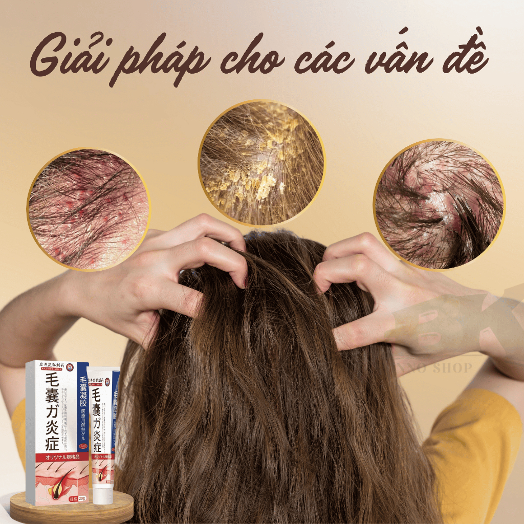 Kem Bôi Viêm Nang Lông Tóc IWAI Nhật Bản 20GR - Hết Gàu Ngứa Mụn Viêm Chân Tóc, Phục Hồi Nang Tóc, Kích Mọc Tóc BK INNO