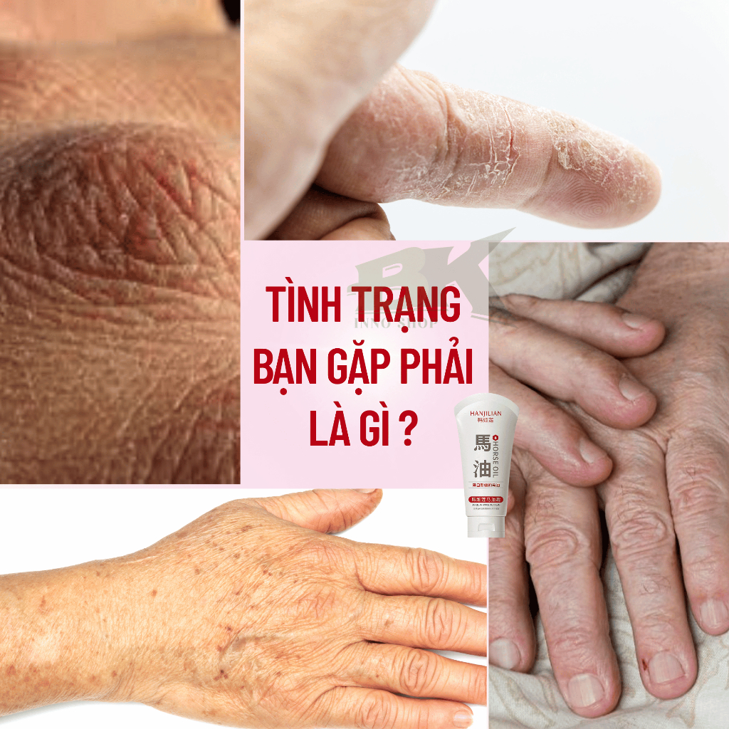 KEM DƯỠNG TAY HANJILIAN CAO CẤP 80GR - Kem Giúp Xoá Nết Nhăn Tay Hiệu Quả, Da Tay Mịn Màng, Trắng Sáng, Loại Bỏ Nám Da