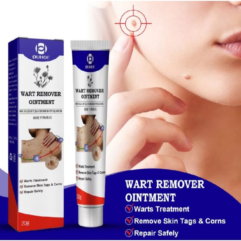 Kem rụng mụn thịt dư, nốt ruồi, nốt ve chó, u mềm treo... OUHOE WART REMOVER OINTMENT