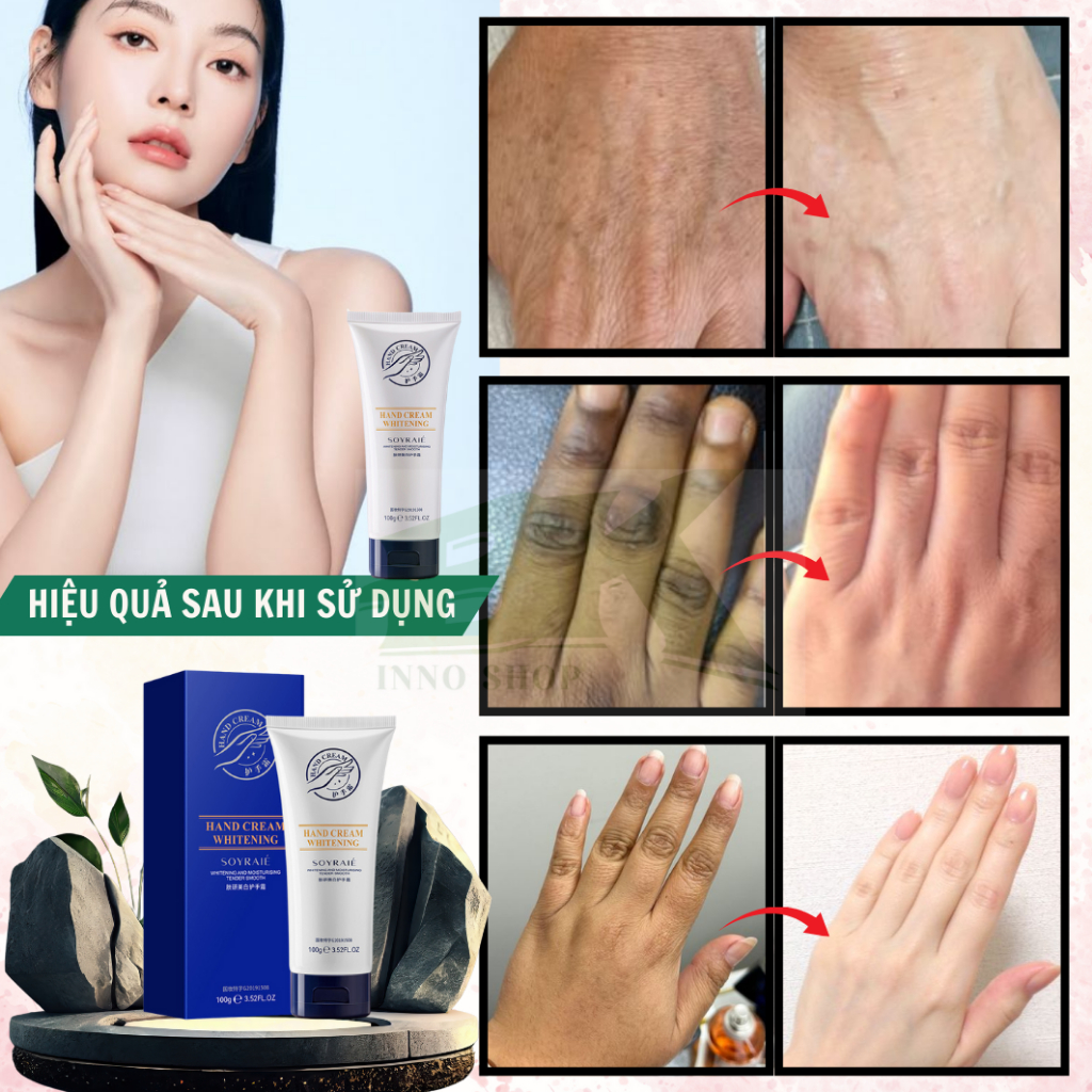 KEM DƯỠNG DA TAY TENDER 100g – CHỐNG KHÔ RÁP, CẤP ẨM TỨC THÌ, DA TAY MỀM MỊN, TRẮNG SÁNG TỰ NHIÊN | BK INNO