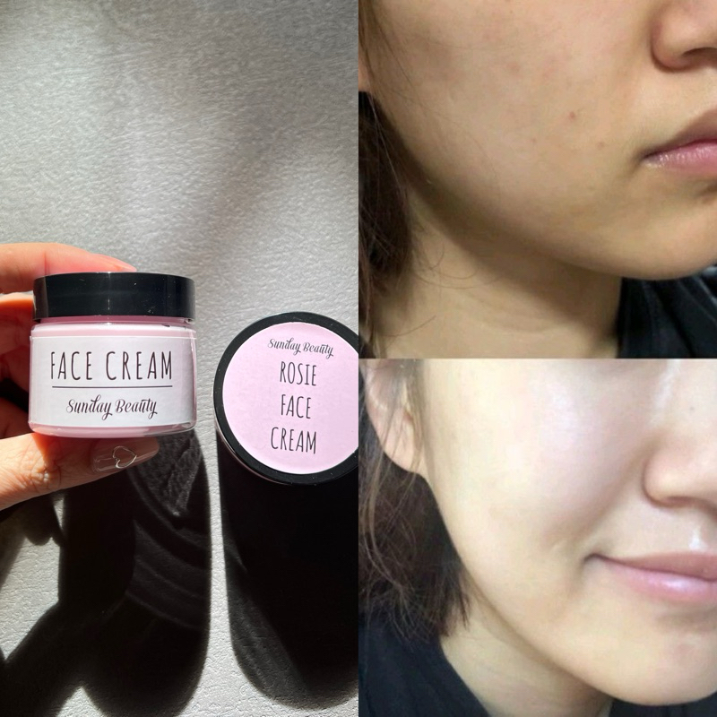 Kem dưỡng Rosie hỗ trợ dưỡng da