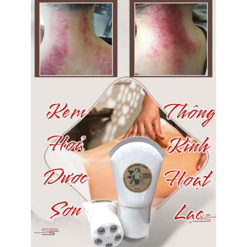𝗖𝗔𝗢  HỎA DƯỢC SƠN 𝗚𝗜𝗔̉𝗠 Đ𝗔𝗨 𝗠𝗢̉𝗜 𝗕𝗔̀𝗜 𝗛𝗔̀𝗡 𝗔̂̉𝗠 🔥