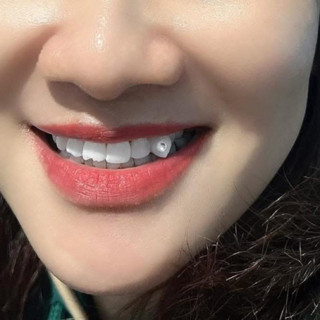 ĐÁ ĐÍNH RĂNG Set 50 viên tặng KEO và Bút dính, tiệm đá An Pi