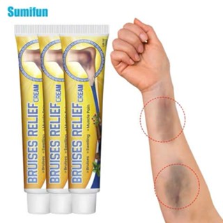  Kem Bôi Ngoài Da Làm Tan Vết Bầm Tím Dịu Nhẹ Cho Da Nhanh Chóng Lấy Lại Làn Da Đều Màu Cho Bạn 