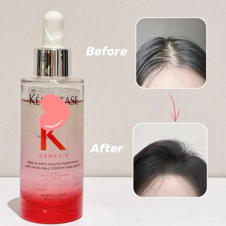 Serum ngừa rụng tóc Genesis 90ml