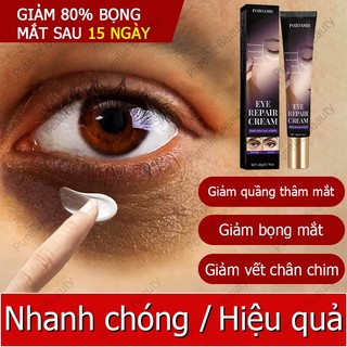 Kem dưỡng mắt  Kem chống lão hóa vùng mắt Kem trị thâm mắt  Giảm quầng thâm Chăm sóc mắt 