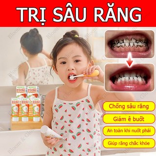 【Chữa sâu răng】Kem đánh răng ngừa sâu răng Chấm sâu răng Chống sâu răng Flour bôi răng cho trẻ Sâu răng hôi miệng