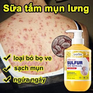  Sữa Tắm Mụn Lưng 500ml Lưu Huỳnh Sữa Tắm Giảm mụn lưng sạch sâu vượt làm sáng da 