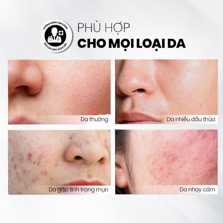 Ảnh 6 của Sữa Rửa Mặt MD CARE MANDELIC 5% GEL CLEANSER Dạng Gel Làm Sạch Sâu ,Tẩy Tế Bào Chết Nhẹ Nhàng