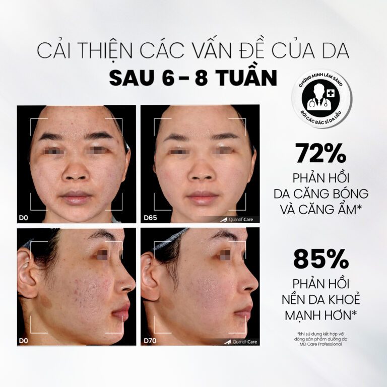 Ảnh 7 của Sữa Rửa Mặt MD CARE MANDELIC 5% GEL CLEANSER Dạng Gel Làm Sạch Sâu ,Tẩy Tế Bào Chết Nhẹ Nhàng