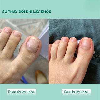 Cây lấy khóe móng cán gỗ nhỏ gọn - Dụng cụ lấy khóe móng tay và móng chân