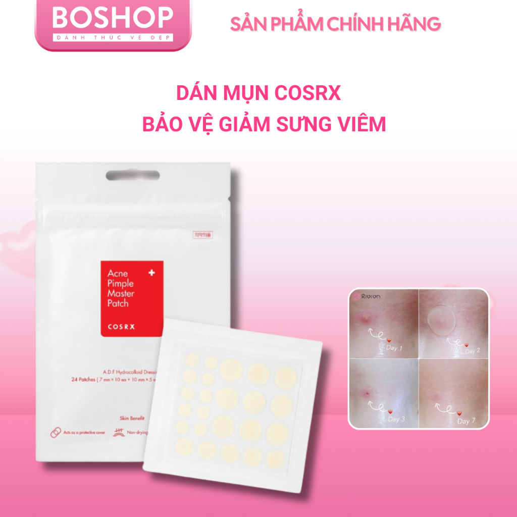 Miếng Dán Mụn Cosrx Acne Pimple 24 Patches Đỏ