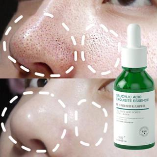 Serum se khít lỗ chân lông Tinh Chất Mịn Màng làm trắng da Loại bỏ vết mụn trứng cá Dưỡng ẩm Axit Salicylic 30ml