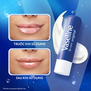 Son dưỡng Môi Mềm Mịn Vaseline Lip Care Stick 4.8g