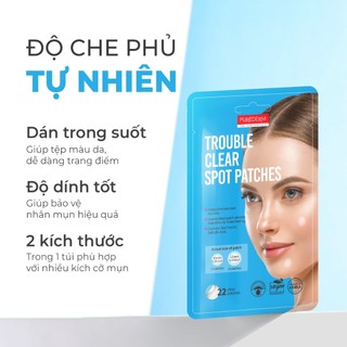 Miếng Dán Mụn Purederm 22 Miếng Giảm Sưng Viêm, Gom Cồi Nhanh, Mờ Thâm Hiệu Quả Cho Mọi Loại Da