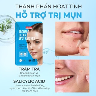 Miếng Dán Mụn Purederm 22 Miếng Giảm Sưng Viêm, Gom Cồi Nhanh, Mờ Thâm Hiệu Quả Cho Mọi Loại Da