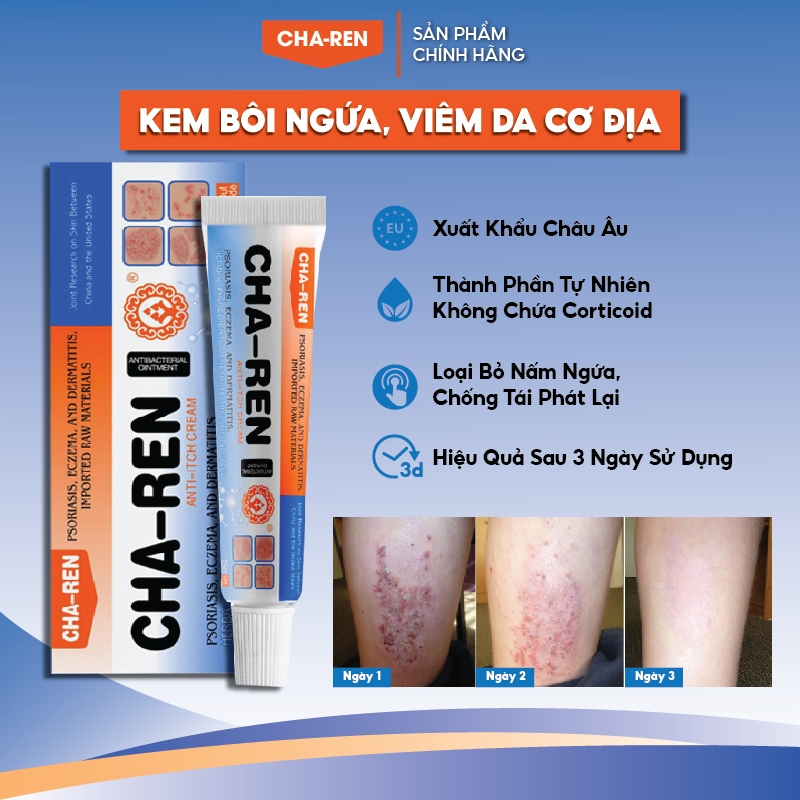 Kem Bôi Nấm Ngứa Viêm Da Cơ Địa CHA-REN Hàng Xuất Khẩu Châu Âu (EU) Dứt Điểm Hắc Lào, Nấm Da Đầu