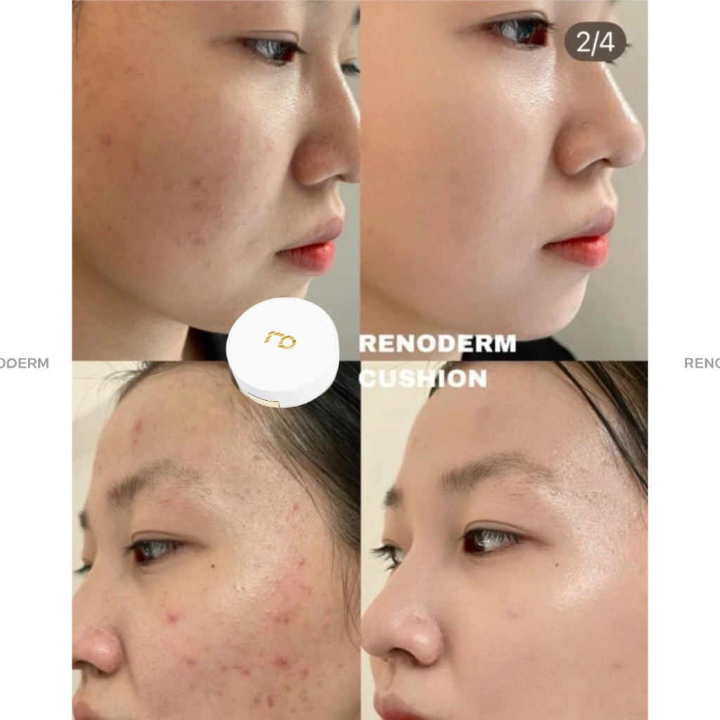 [MALL HÃNG] Phấn Nước Cushion RenoDerm DAY LONG BB CREAM SILVER Tone Sáng Che Phủ Cao Mịn Lì Phù Hợp Da Dầu Da Treatment | BigBuy360 - bigbuy360.vn