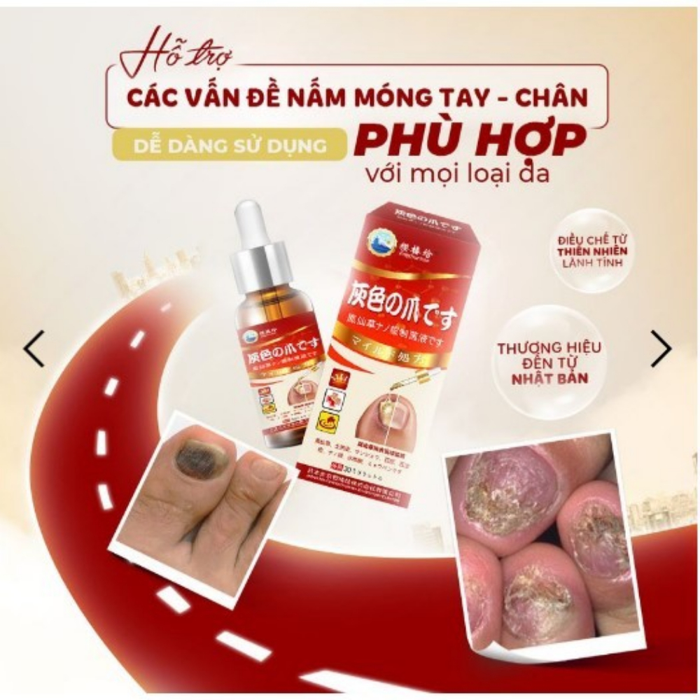 Tinh chất nấm móng Nhật Bản KANNEDO - KANNEDO tinh chất giảm nấm móng, hư móng, dưỡng móng dày chắc khỏe - MINT COSMETIC