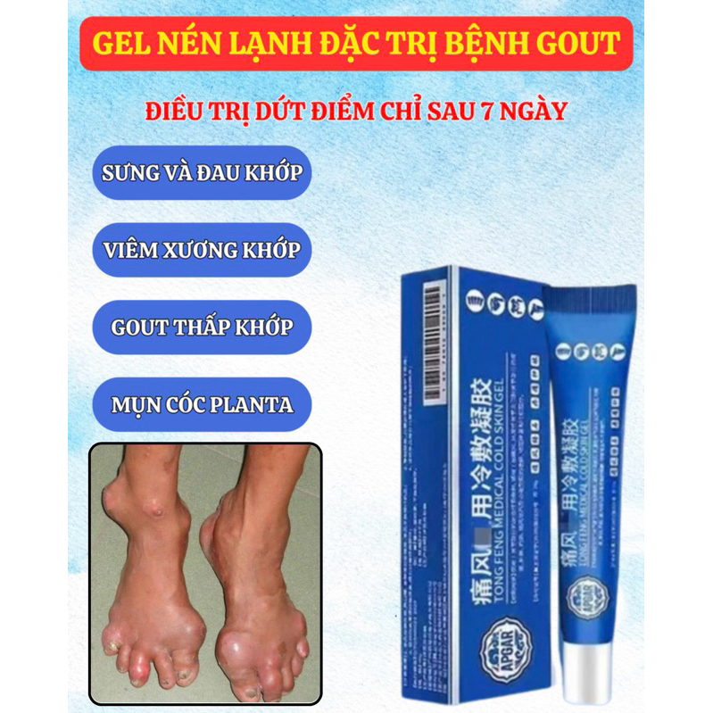 Gel nén lạnh Baoyuantang Gout, khớp ngón tay, sưng, thắt lưng, chân và đầu gối, tác dụng đặc biệt