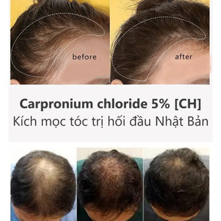 Tinh chất thảo mộc Mọc Tóc Sato Arovics Solutions 5%