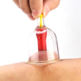 Bộ giác hơi 24 cốc không dùng lửa