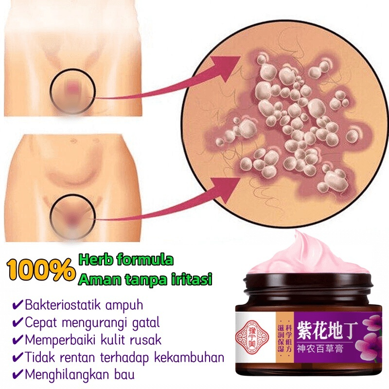 Kem Sumifun bôi Nấm chống ngứa, Sùi Mào Gà, Mụn Cóc, Mụn Cơm Ngứa Vùng Kín Nam Nữ, hết ngứa ngay lập tức