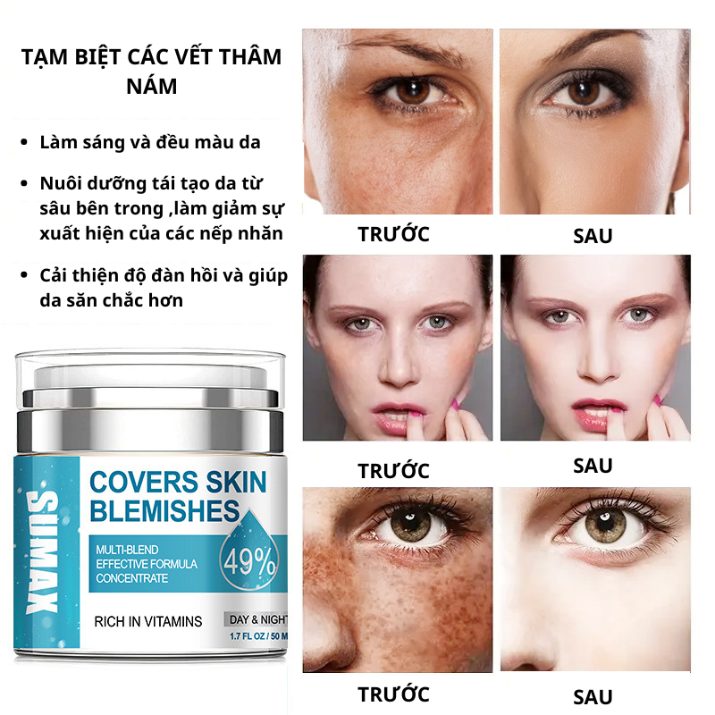 Combo Bộ 3 Chăm Sóc Sắc Đẹp Cho Mẹ Sau Sinh An Toàn Hiệu Quả Kem Nám Tàn Nhang ,Rạn Da , Kem Tan Mỡ