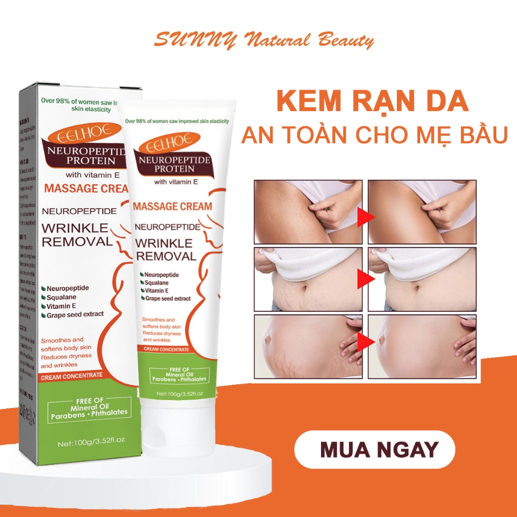 Kem Rạn Da An Toàn Cho Mẹ Bầu Trẻ Mới Lớn Hỗ Trợ Làm Trắng Giảm Sẹo Giúp Da Săn Chắc Mịn Màng EELHOE