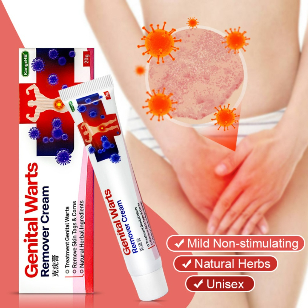 KEm bôi Genital Warts Sùi Mào Gà, Mụn Cóc, Mụn Cơm Vùng Kín Nam Nữ, hết ngứa ngay lập tức