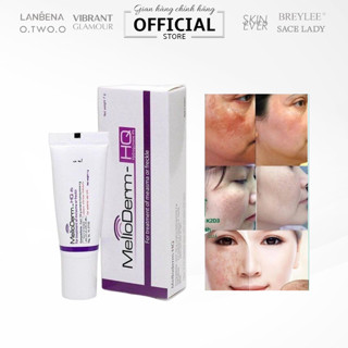 Kem dưỡng da giảm sắc tố, khắc phục nám, tàn nhang, đồi mồi melloderm 4%