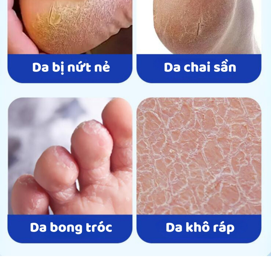 Kem Nứt Gót Chân Dầu Ngựa Dạng Kem Giúp Làm Mềm Hiệu Quả Vùng Da Bị Nứt Nẻ Dạng Hủ 50g