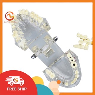 Mô hình rút răng thực hành nha khoa