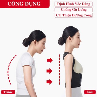 ✈️[Freeship] Đai chống gù lưng nam nữ EASY  [Tặng kèm 2 tấm trợ lực]