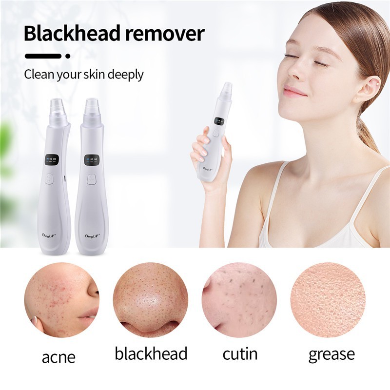 Máy hút mụn GOKE làm sạch lỗ chân lông kèm 5 đầu hút chuyên dụng bảo hành 1 năm | BigBuy360 - bigbuy360.vn