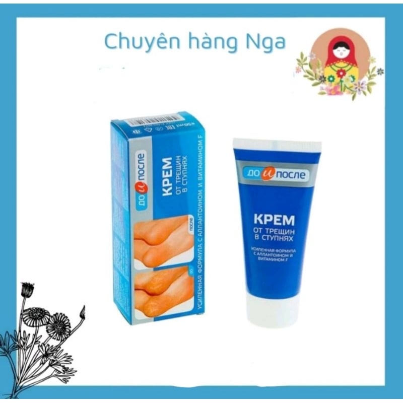 Kem  nứt gót chân nga 50ml
