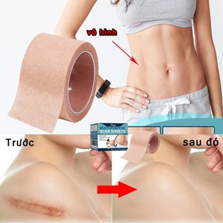 miếng dán che sẹo Và hình xăm Chống thấm nước và mồ hôi che lõm sẹo thâm, sẹo phẫu thuật, Vết sẹo sinh m, hình xăm