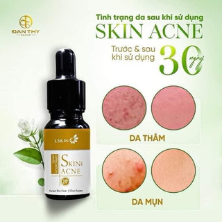 [CHÍNH HÃNG kèm 🎁 ]CỐT MỤN BẠCH SEN ĐAN THY