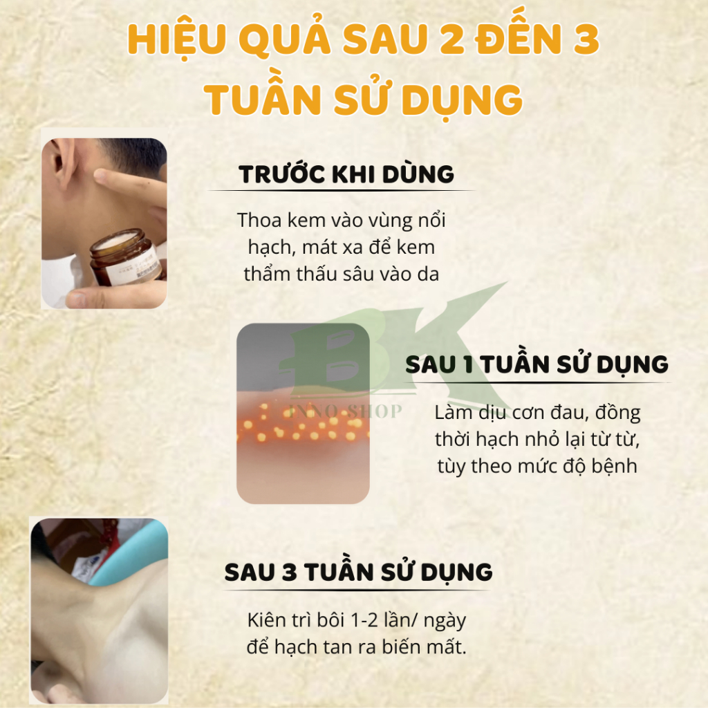 Kem Tan Hạch Bạch Huyết Cổ Truyền Nhật Bản Hỗ Trợ Teo Hạch, Giảm Sưng Đau Nhanh Chóng, Giúp Lưu Thông Mạch Máu | BK INNO